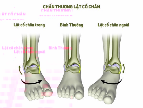 Có cần phải đến bác sĩ sau khi bị lật sơ mi không?